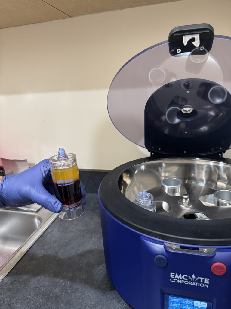 PRP Facial in Northville, MI